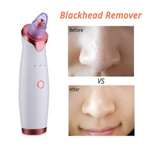 Load image into Gallery viewer, Facial Vacuum Pore Cleaner